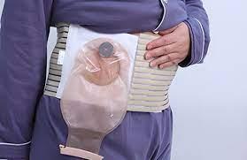 Kolostomi Bak�m�